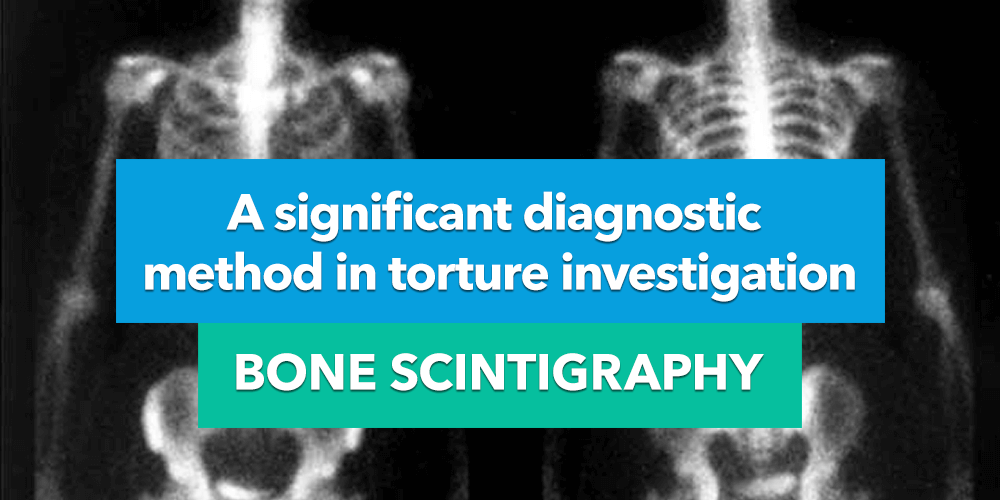 A Significant Diagnostic Method in Torture Investigation: Bone Scintigraphy